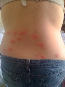 pico rivera bed bugs